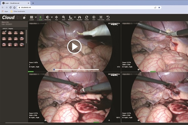 Sharing Medical Videos in Gastroenterology: Best Practices for Security, Collaboration & Patient Care