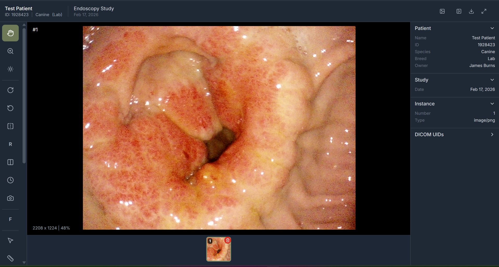 CloudEndo Viewer — endoscopy image with patient metadata, annotation tools, and DICOM tag browser
